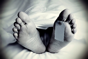 embalming